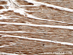 MACF1 Antibody in Immunohistochemistry (Paraffin) (IHC (P))