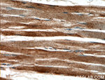 MACF1 Antibody in Immunohistochemistry (Paraffin) (IHC (P))