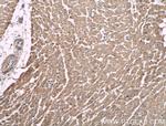 MACF1 Antibody in Immunohistochemistry (Paraffin) (IHC (P))