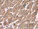 MACF1 Antibody in Immunohistochemistry (Paraffin) (IHC (P))