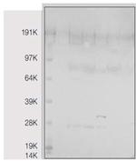 Heme Oxygenase-1 Antibody in Western Blot (WB)