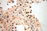 CDK2AP1 Antibody in Immunohistochemistry (Paraffin) (IHC (P))
