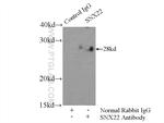 SNX22 Antibody in Immunoprecipitation (IP)