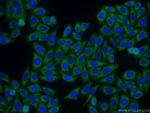 SAMSN1 Antibody in Immunocytochemistry (ICC/IF)