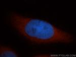 DNAJB4 Antibody in Immunocytochemistry (ICC/IF)