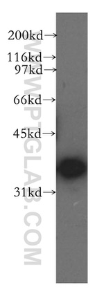DNAJB4 Antibody in Western Blot (WB)