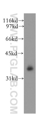 DNAJB4 Antibody in Western Blot (WB)