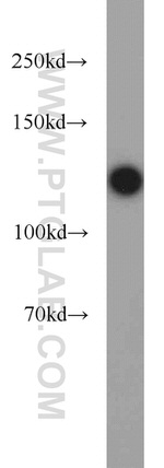 SMARCA5 Antibody in Western Blot (WB)