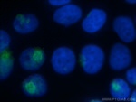 MCFD2 Antibody in Immunocytochemistry (ICC/IF)