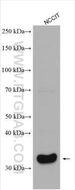 NKX3-1 Antibody in Western Blot (WB)