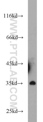 NKX3-1 Antibody in Western Blot (WB)