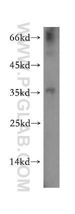NKX3-1 Antibody in Western Blot (WB)