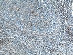 CD97 Antibody in Immunohistochemistry (Paraffin) (IHC (P))