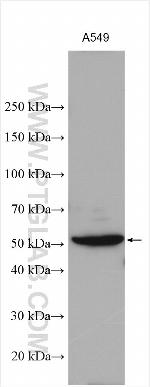 DFNA5 Antibody in Western Blot (WB)