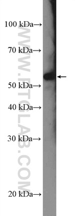 DFNA5 Antibody in Western Blot (WB)