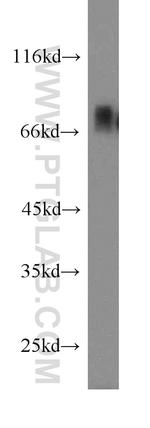 DBF4 Antibody in Western Blot (WB)