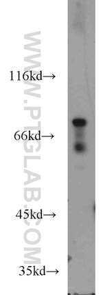 DBF4 Antibody in Western Blot (WB)