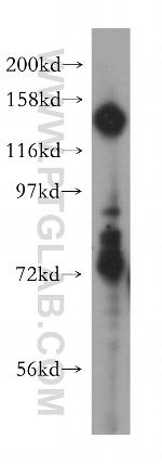 PTPRA Antibody in Western Blot (WB)