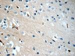PEX5L Antibody in Immunohistochemistry (Paraffin) (IHC (P))