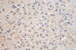 PEX5L Antibody in Immunohistochemistry (Paraffin) (IHC (P))