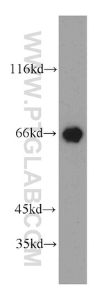 PEX5L Antibody in Western Blot (WB)