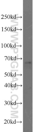 PEX5L Antibody in Western Blot (WB)