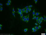 FREM1 Antibody in Immunocytochemistry (ICC/IF)
