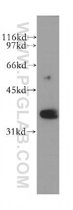RHOXF2 Antibody in Western Blot (WB)
