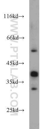 RHOXF2 Antibody in Western Blot (WB)