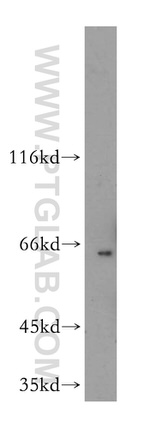 MITF Antibody in Western Blot (WB)