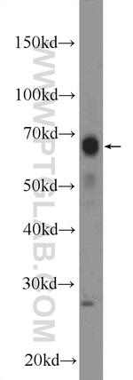 MITF Antibody in Western Blot (WB)