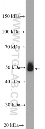 ADRB2 Antibody in Western Blot (WB)