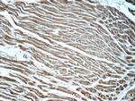 ADRB2 Antibody in Immunohistochemistry (Paraffin) (IHC (P))