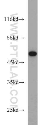 ADRB2 Antibody in Western Blot (WB)
