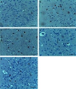 COX2 Antibody in Immunohistochemistry (Paraffin) (IHC (P))