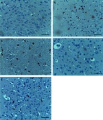 COX2 Antibody in Immunohistochemistry (Paraffin) (IHC (P))