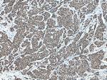 MLF1 Antibody in Immunohistochemistry (Paraffin) (IHC (P))