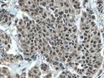 MLF1 Antibody in Immunohistochemistry (Paraffin) (IHC (P))