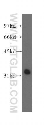 MLF1 Antibody in Western Blot (WB)