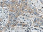 KIF2A Antibody in Immunohistochemistry (Paraffin) (IHC (P))