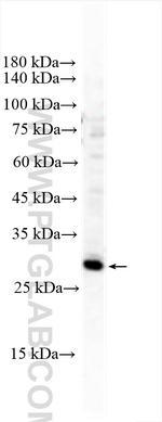 ELF5 Antibody in Western Blot (WB)
