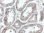 UBXN11 Antibody in Immunohistochemistry (Paraffin) (IHC (P))