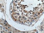 UBXN11 Antibody in Immunohistochemistry (Paraffin) (IHC (P))