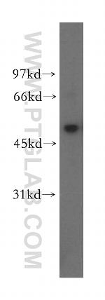 UBXN11 Antibody in Western Blot (WB)