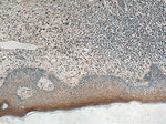 IL36RN Antibody in Immunohistochemistry (Paraffin) (IHC (P))