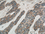 IL36RN Antibody in Immunohistochemistry (Paraffin) (IHC (P))