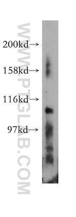 EPHA7 Antibody in Western Blot (WB)