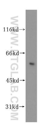 PPP2R2B Antibody in Western Blot (WB)
