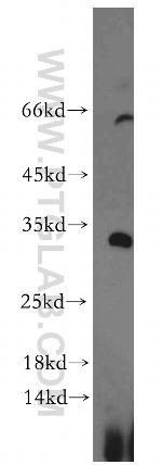 KLF7 Antibody in Western Blot (WB)
