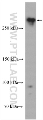 USP24 Antibody in Western Blot (WB)